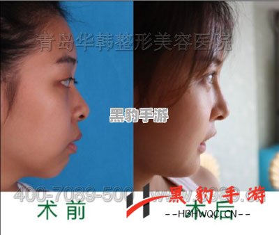 如何在Yoya世界中实现完美的整容蜕变？ - 黑豹手游网-1